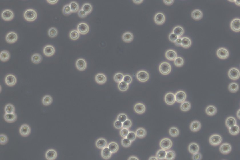 Baker's yeast (Saccharomyces cerevisiae) under the microscope